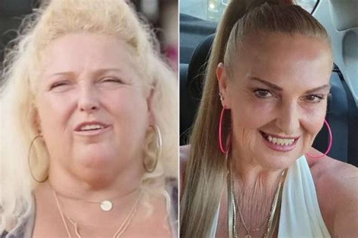 Angela Deem Plastic Surgery 2023: Before And After Photos