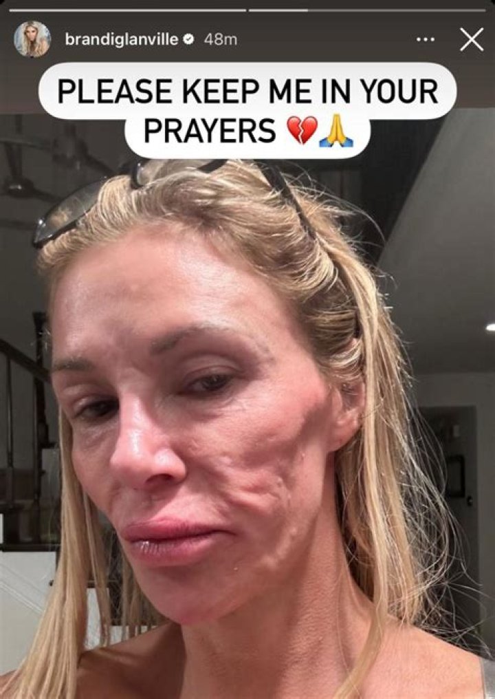 Brandi Glanville Reveals Dog Was Attacked By a Wolf