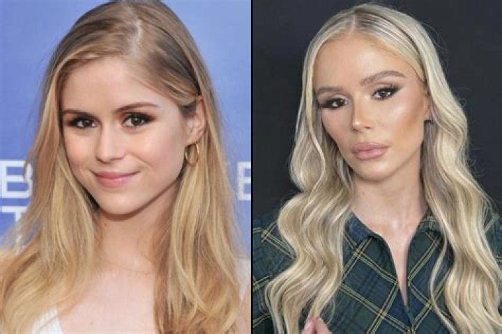 
Emma Booth Plastic Surgery Before And After: Outlast Cast Accident And Health Update 