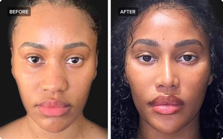 Gabrielle Union Nose Job Plastic Surgery Before And After Photos