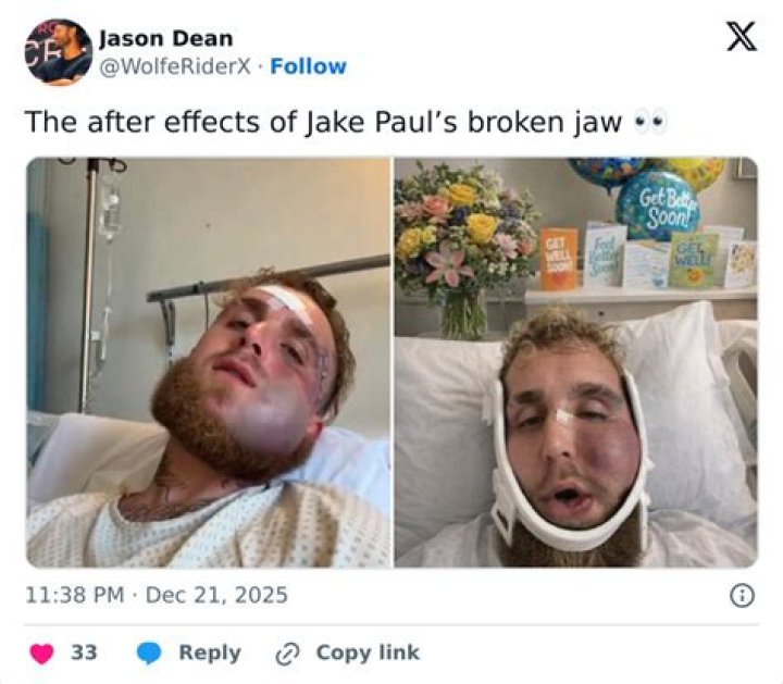 How do you sleep with a broken jaw?