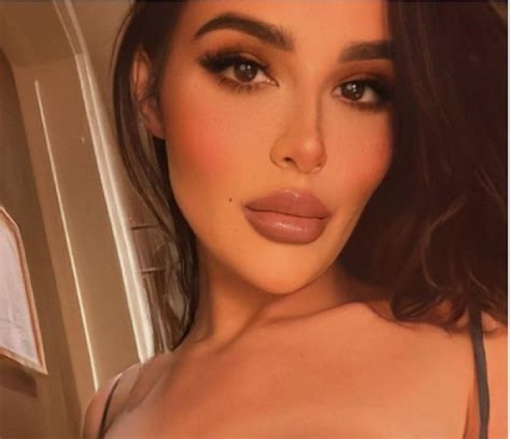 Ines Helene Before Plastic Surgery: Botox And Lip Filler