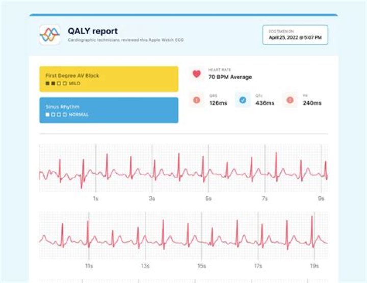 Is a prolonged PR interval dangerous?