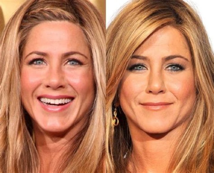 Jennifer Aniston Nose Job: Botox And Lip Filler Before And After Photos