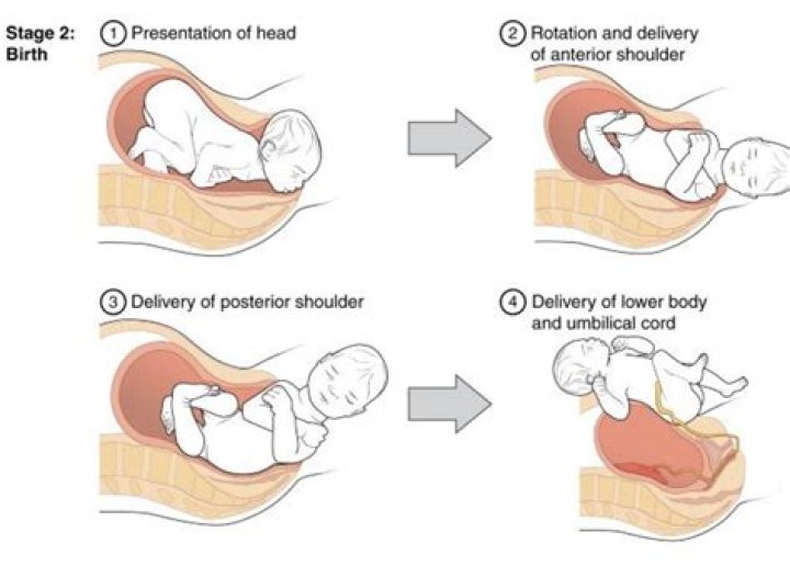 Jill Duggar was in labor for 70 hours before she had a C-section