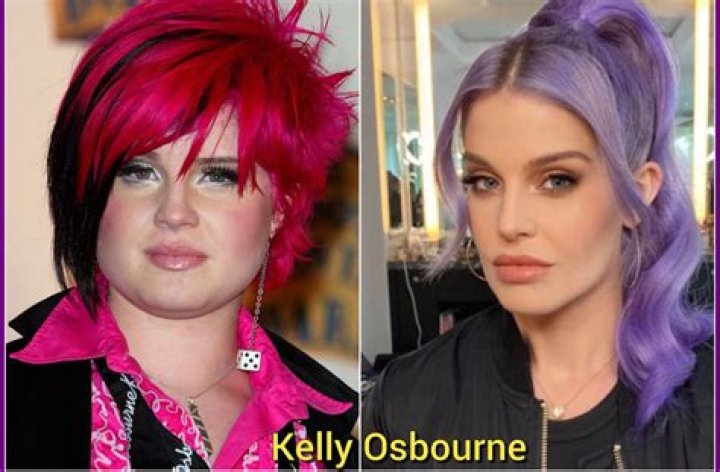 Kelly Osbourne Before And After Plastic Surgery, Age And Husband