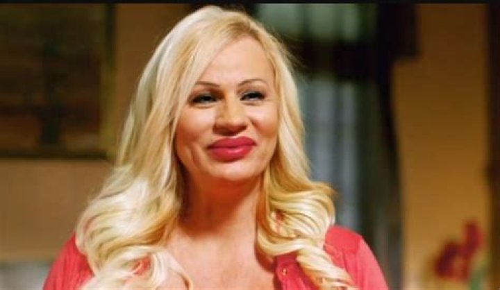 Lacey Wildd Before & After Plastic Surgery