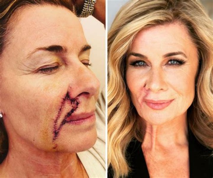 Lauren Hutton on plastic surgery: ‘There are people I find hard to look at’