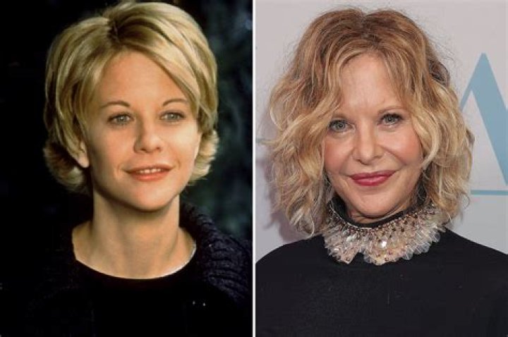 Meg Ryan has stopped injecting her lips with crazy