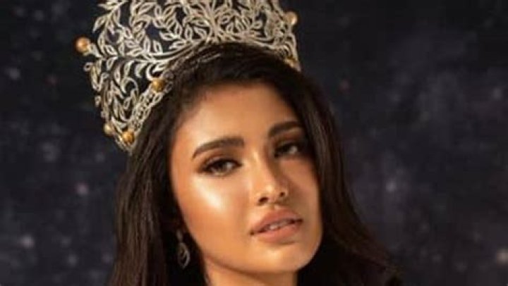 Rabiya Mateo Plastic Surgery: Fans Suspect Botox And Lip Filler