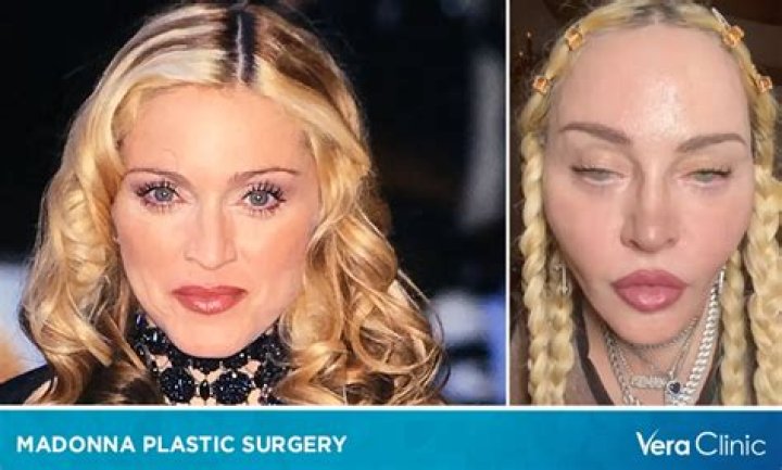 Random plastic surgeon thinks Madonna had a ‘ribbon lift’