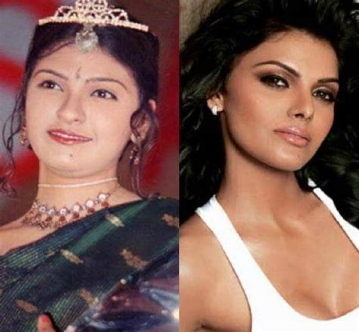 Sherlyn Chopra Plastic Surgery: Before And After Photos