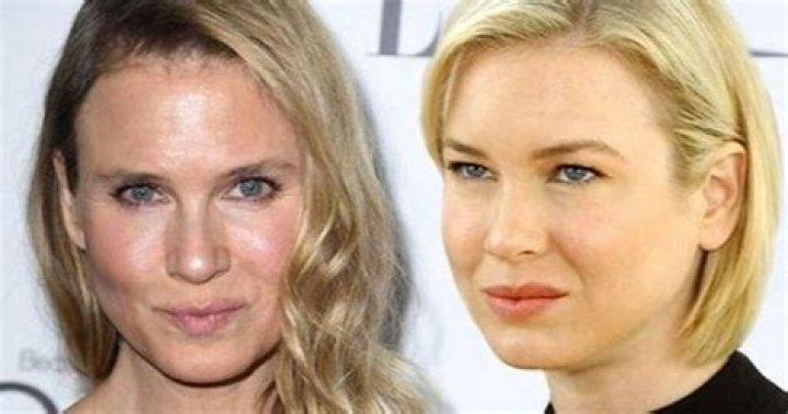 Us Weekly: Renee Zellweger changed her face because ‘the parts started drying up’
