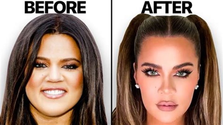 Wait, Khloe Kardashian’s ‘bad nose job’ look was just makeup contouring?