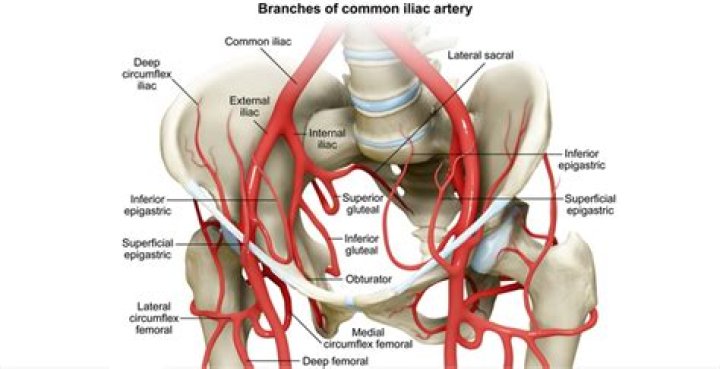What are the branches of the internal iliac artery?