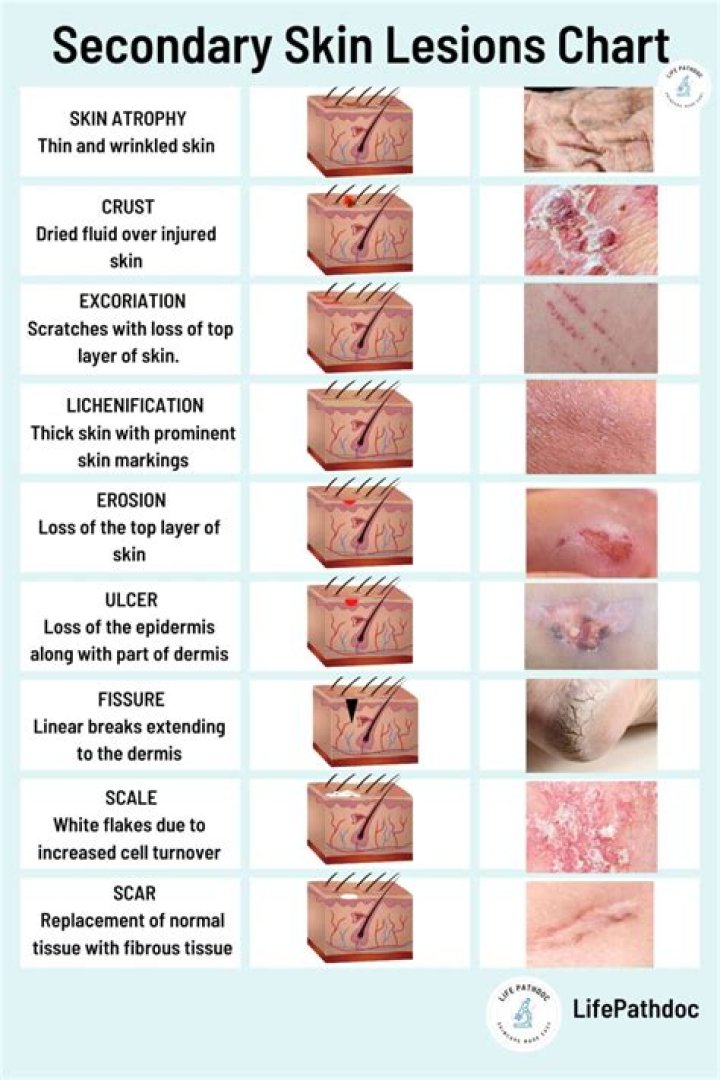 What is lesion studies?