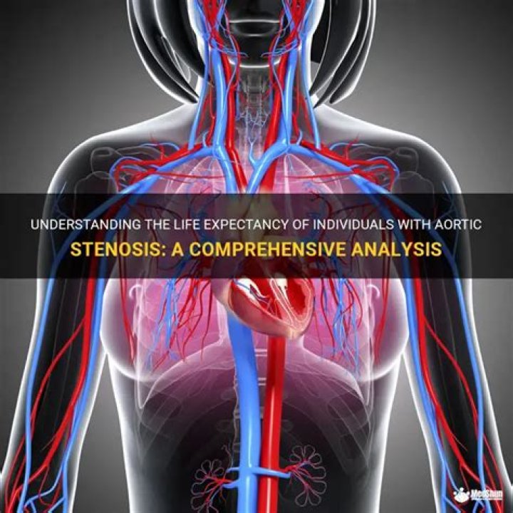 What is the life expectancy of someone with aortic stenosis?