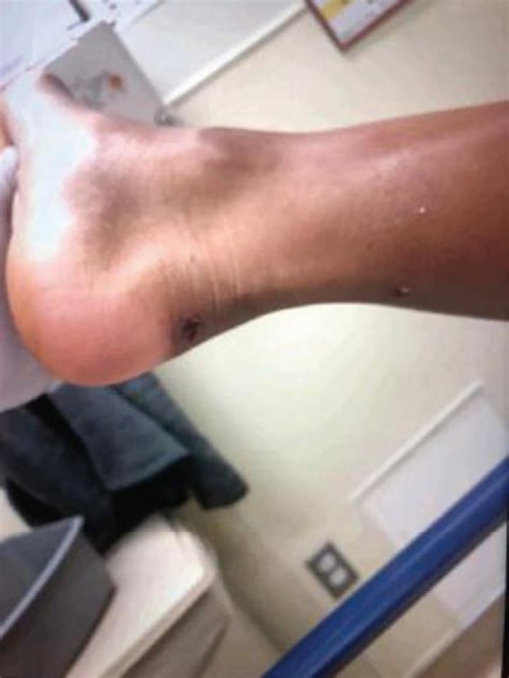
When was Megan Thee Stallion shot? Foot injury pictures surface from Tory Lanez trial 