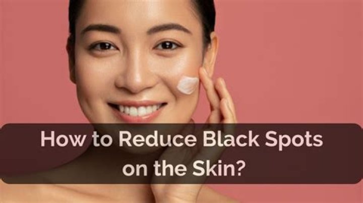 Why do my peaches have black spots?